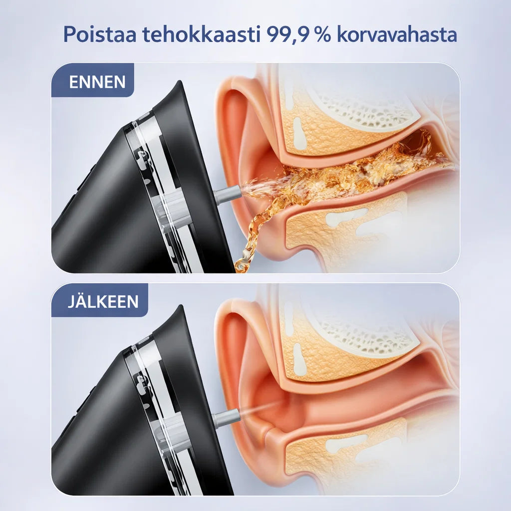 KorvaPuhdas – Puhdas olo korviin minuuteissa