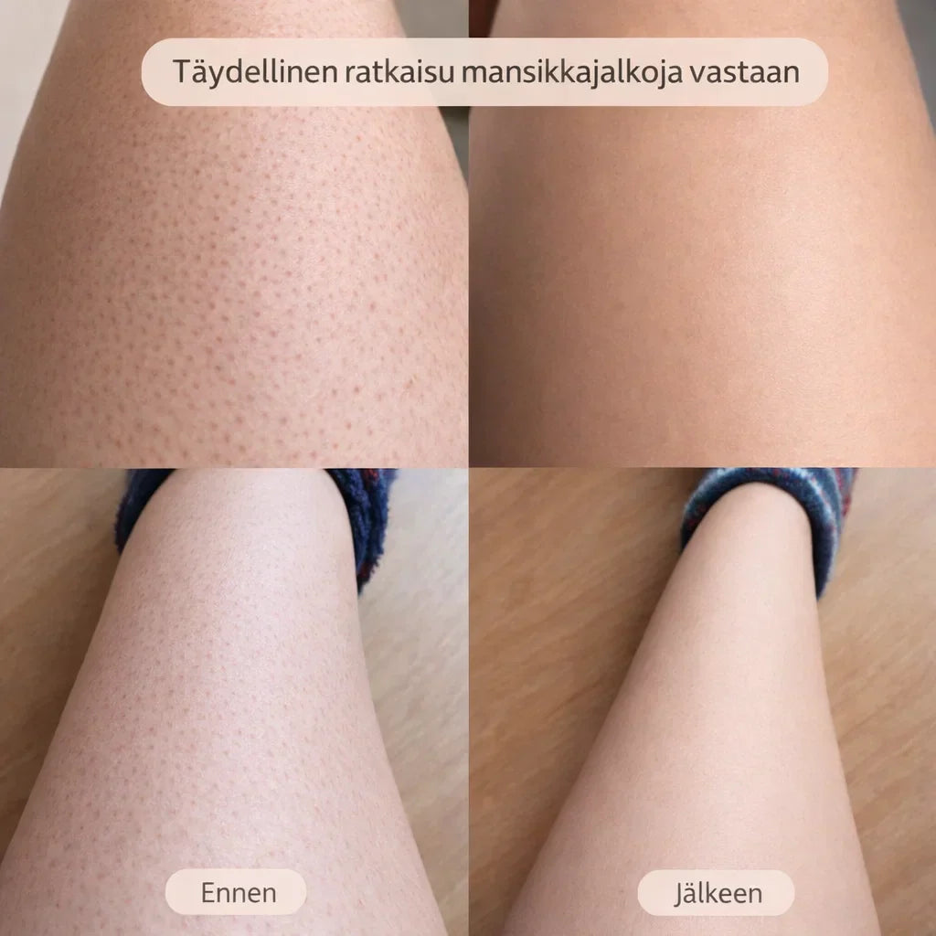 SilvaTrim – 2-in-1 karvanpoistaja sileään ihoon